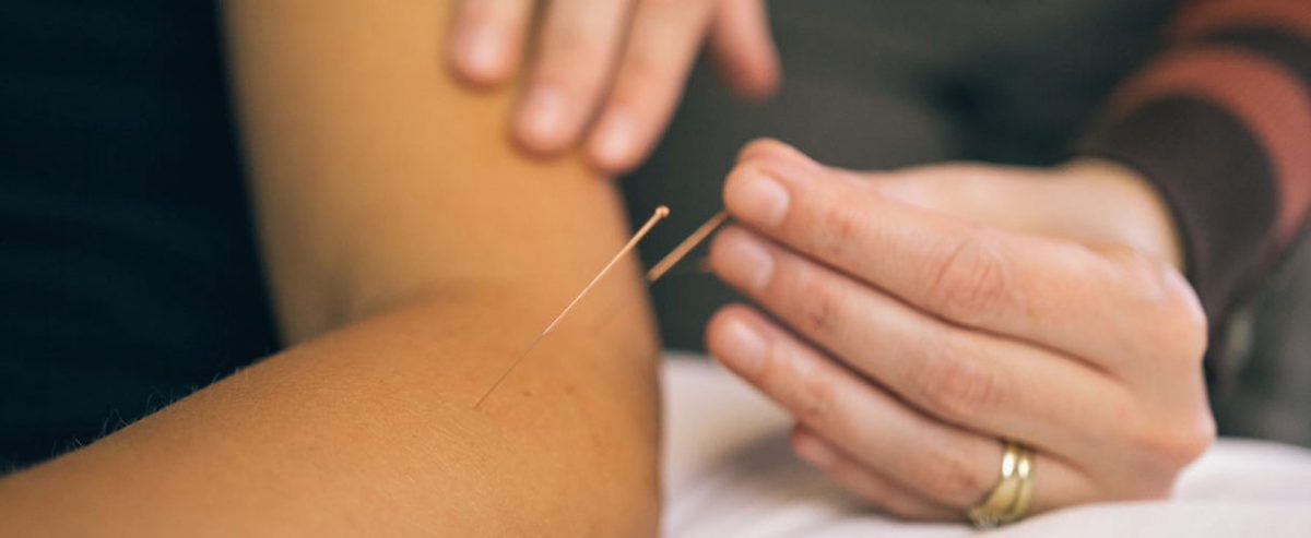 Acupuncture Therapy | Clayton Heights 188 St Physiotherapy and Sport Injury Clinic