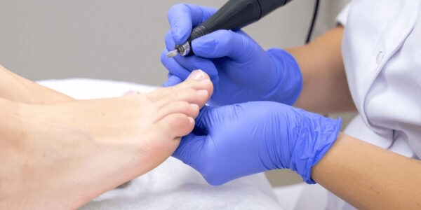 Foot Care Surrey service photo