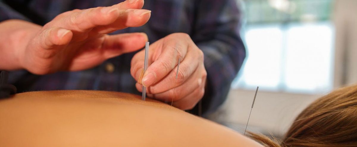 Traditional Chinese Medicine and Acupuncture | Clayton Heights 188 St